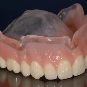 Partial Dentures